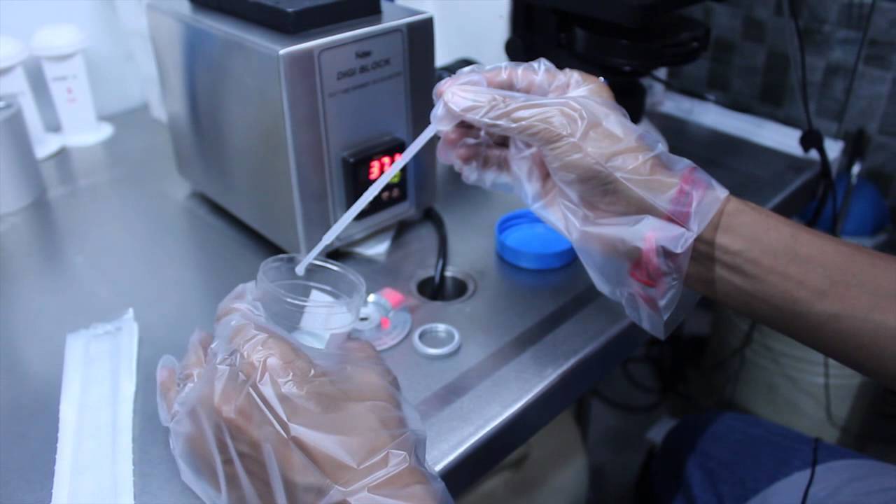 Фото: ЭКО при гидросальпинксе