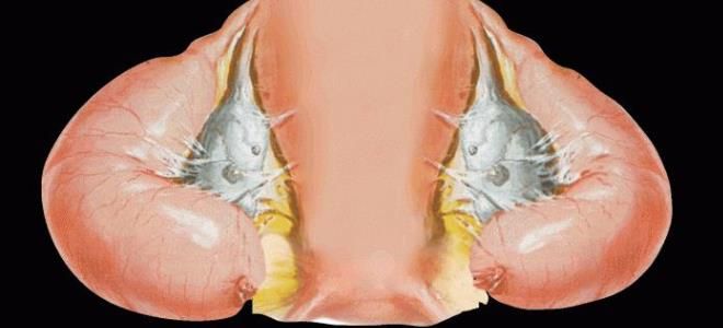 Фото: Виды гидросальпинкса