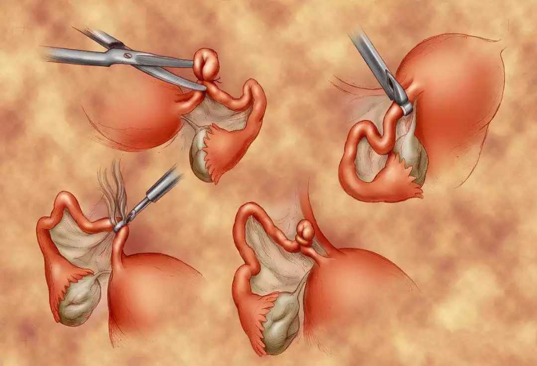 Фото: Хирургическое лечение